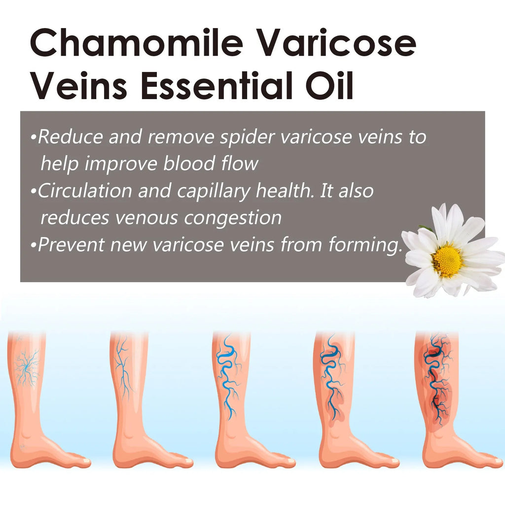 10ml glass bottle of pure chamomile essential oil for leg massage and skin relief.