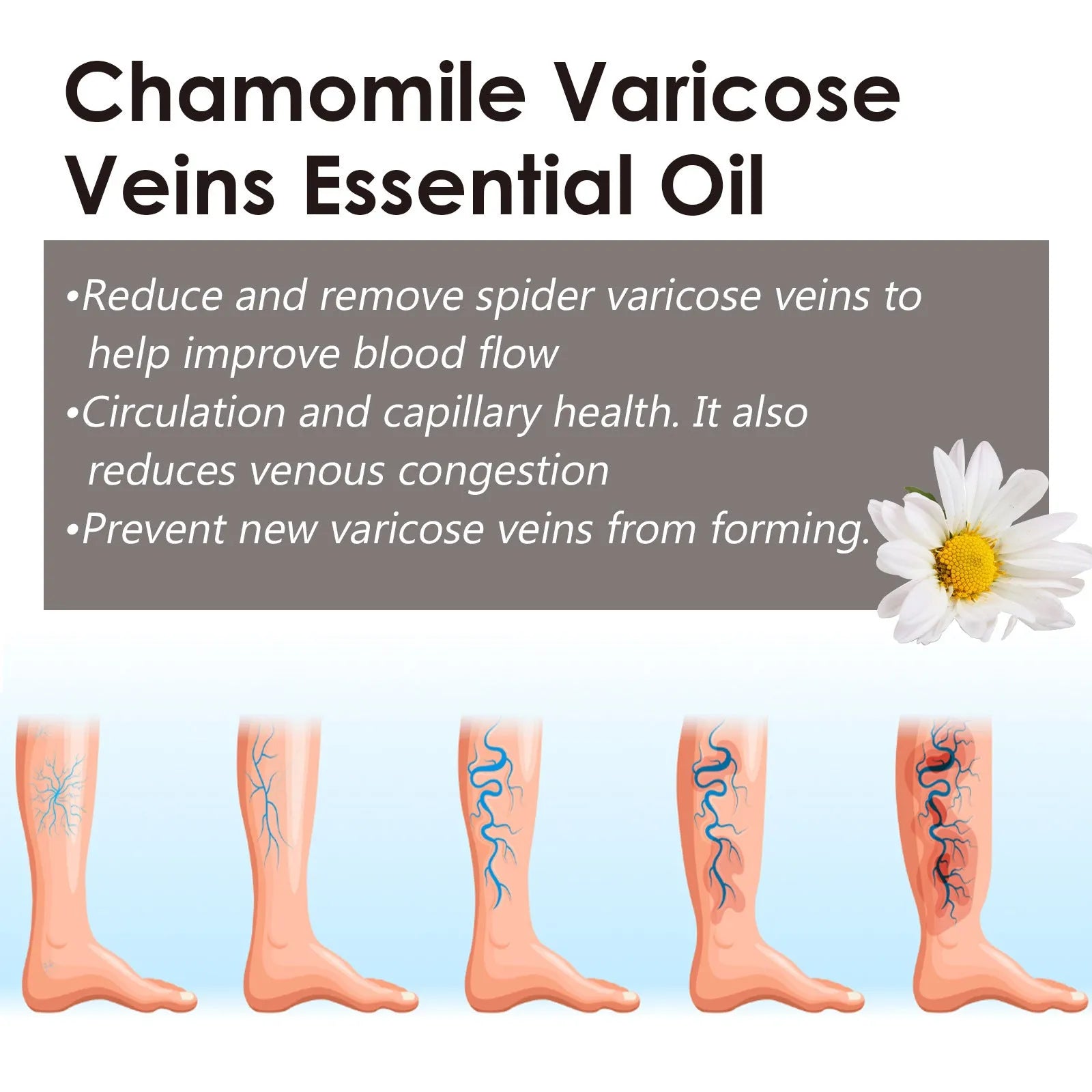 10ml glass bottle of pure chamomile essential oil for leg massage and skin relief.