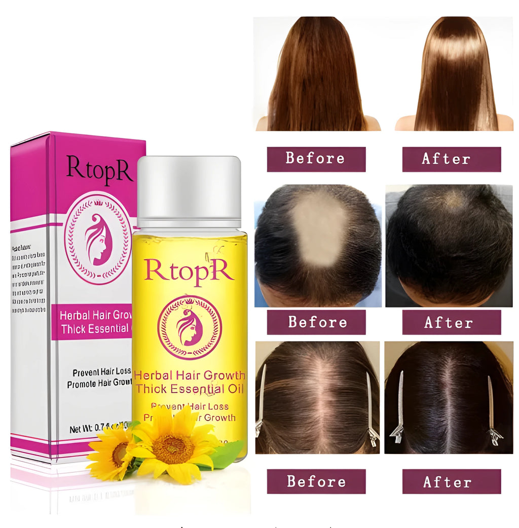 Hair growth essential oil liquid treatment 20ml bottle rose colour preventing hair loss