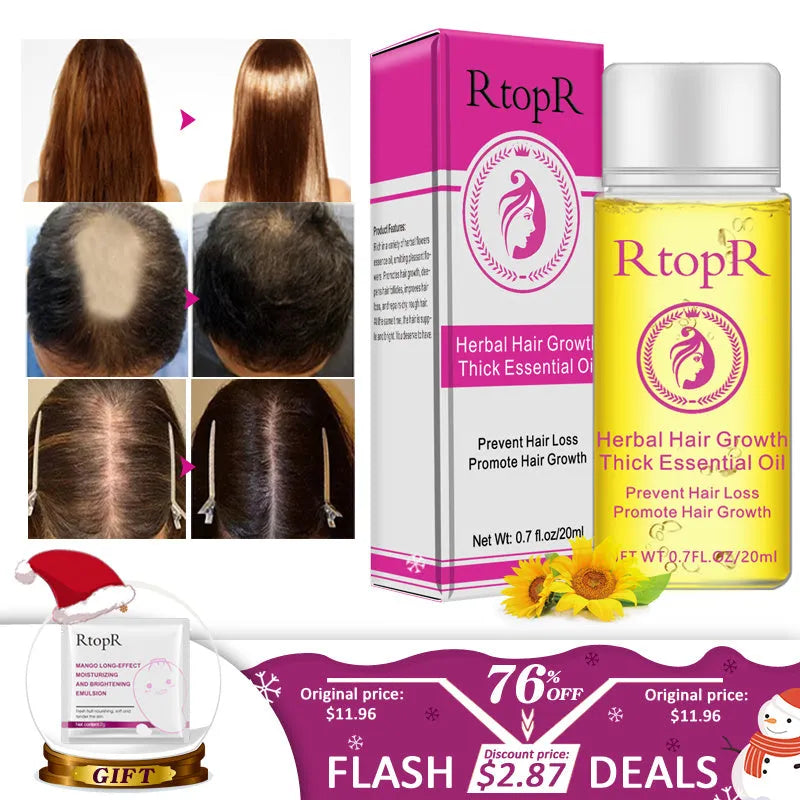 Hair growth essential oil liquid treatment 20ml bottle rose colour preventing hair loss