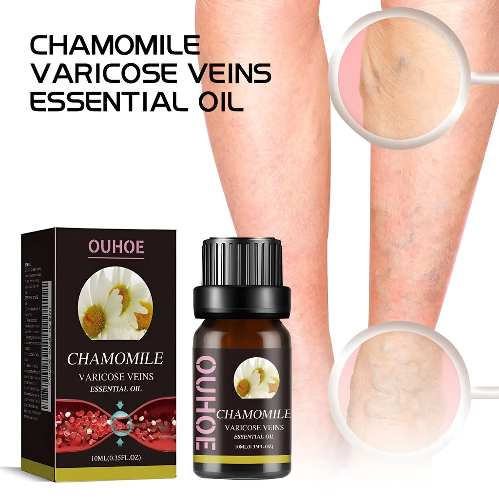 10ml glass bottle of pure chamomile essential oil for leg massage and skin relief.