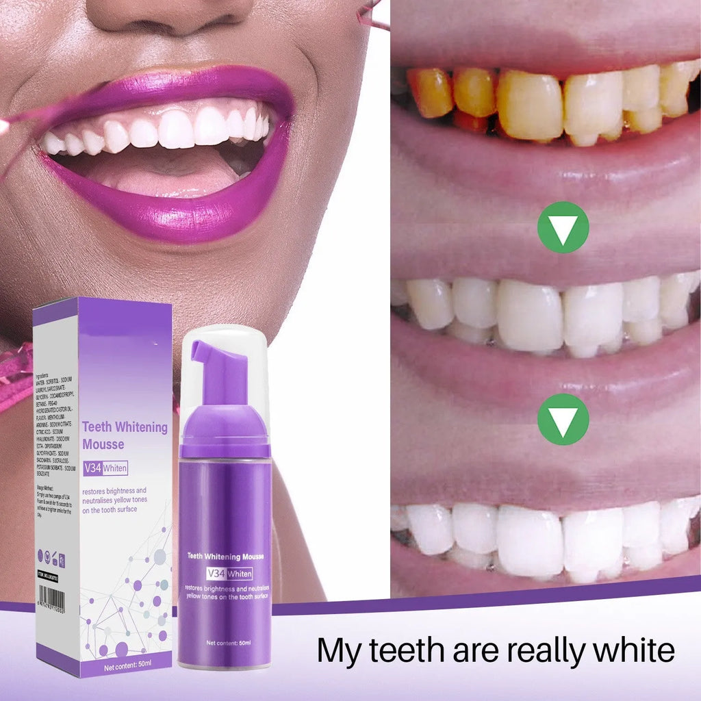 Oral care teeth mousse 50ml tube for removing smoke stains and smoke spots from teeth