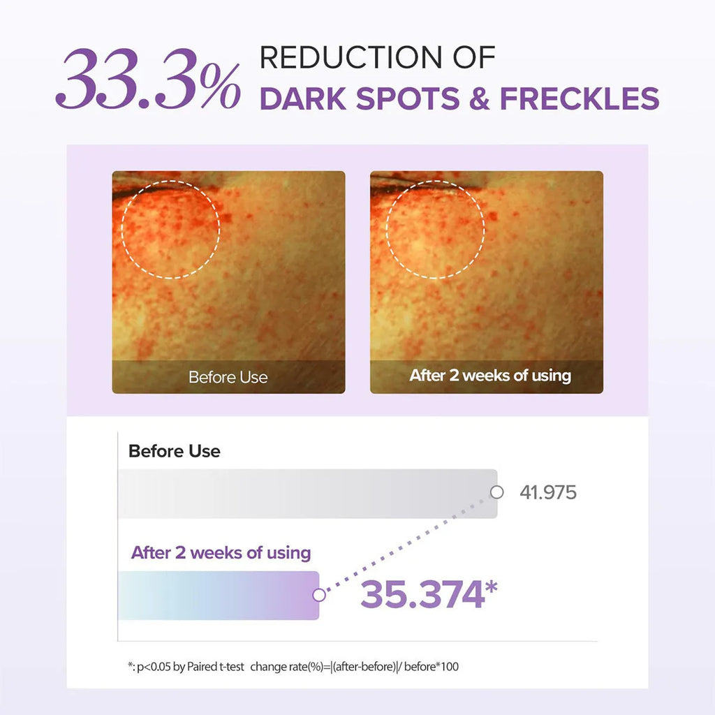 Moisturising eye neck cream 30ml standard specification for dark circles and hydration