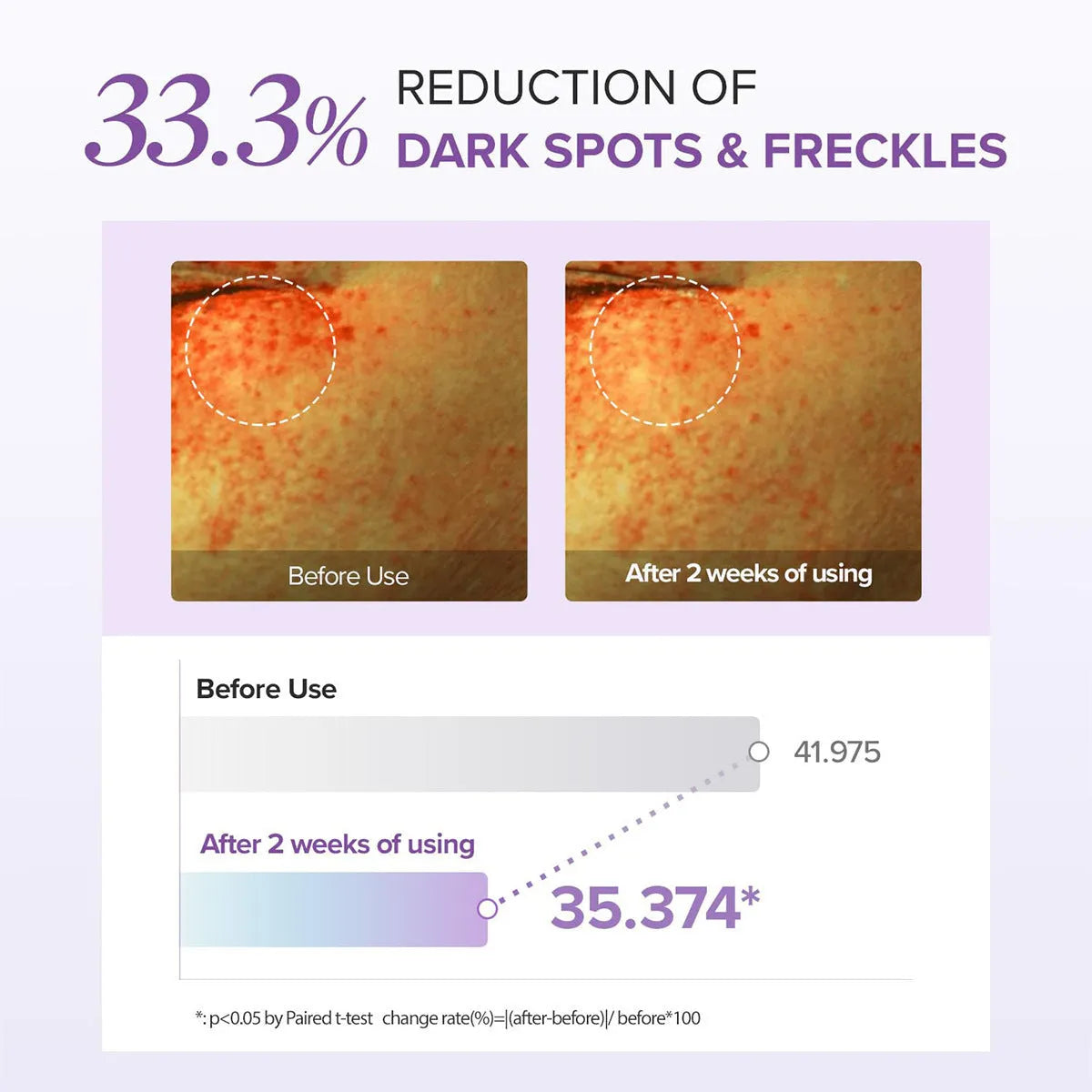Moisturising eye neck cream 30ml standard specification for dark circles and hydration