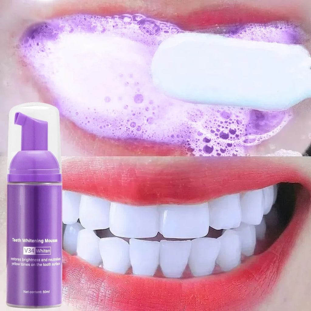 Oral care teeth mousse 50ml tube for removing smoke stains and smoke spots from teeth