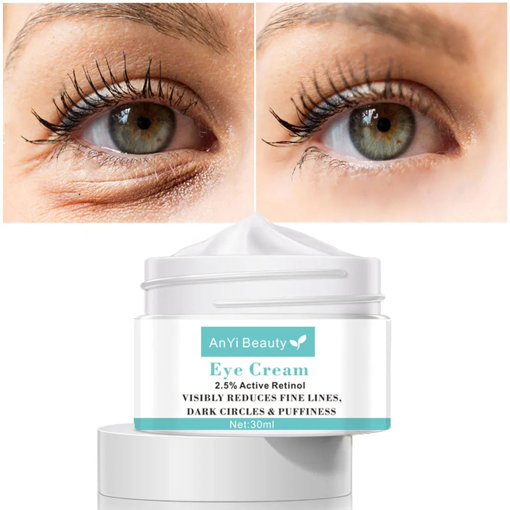30ml eye cream for women anti-wrinkle dark circle reduction beauty product