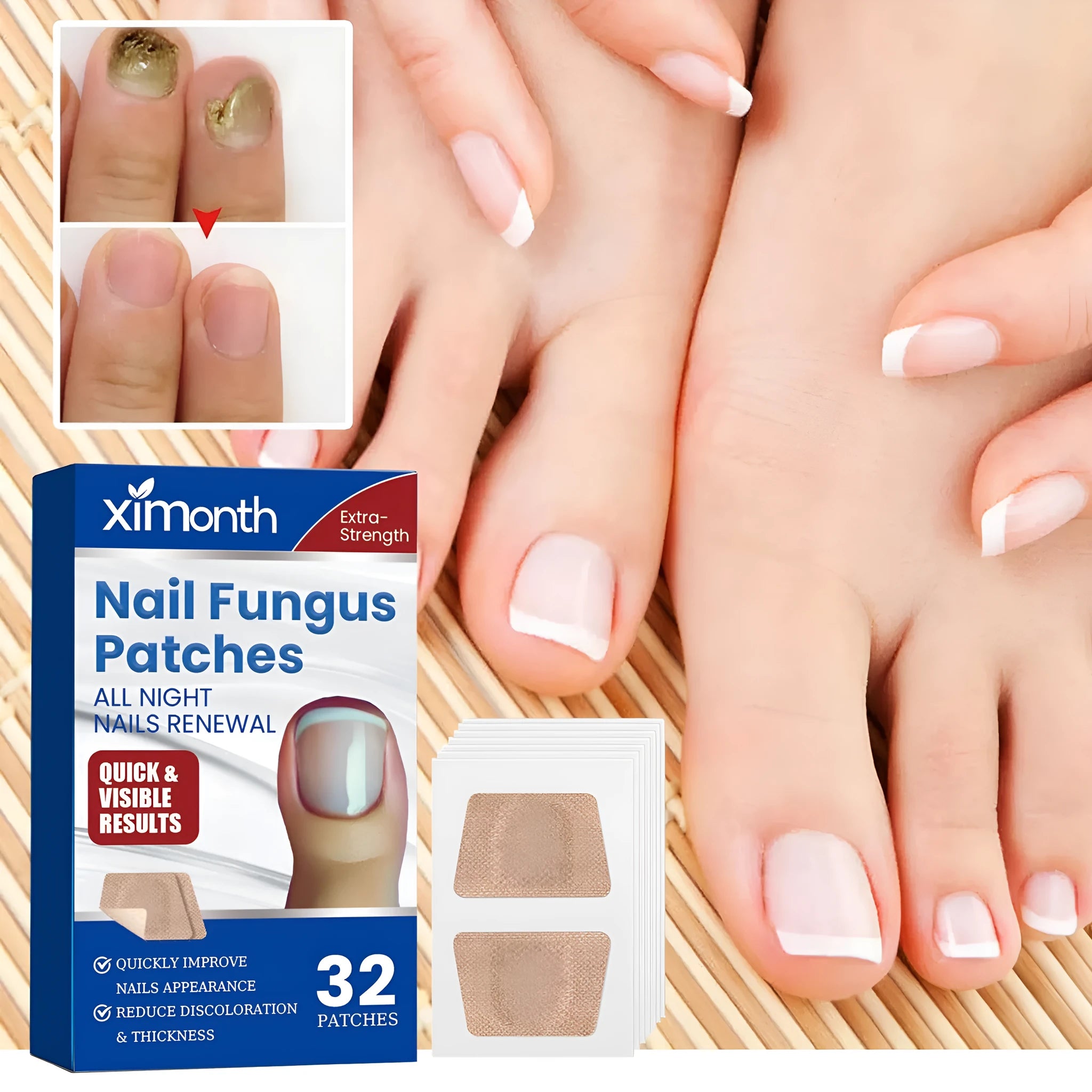 Box of 32 nail nursing adhesive bandage repair patches for damaged nail care.
