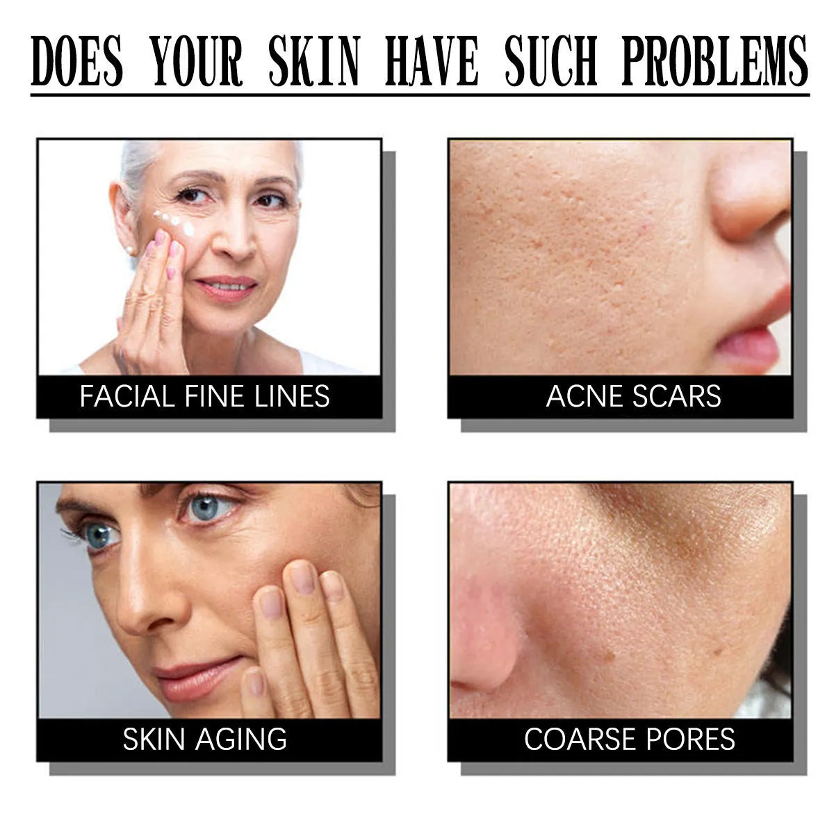 A 50g jar of salicylate exfoliating and moisturising facial cream for all skin types.