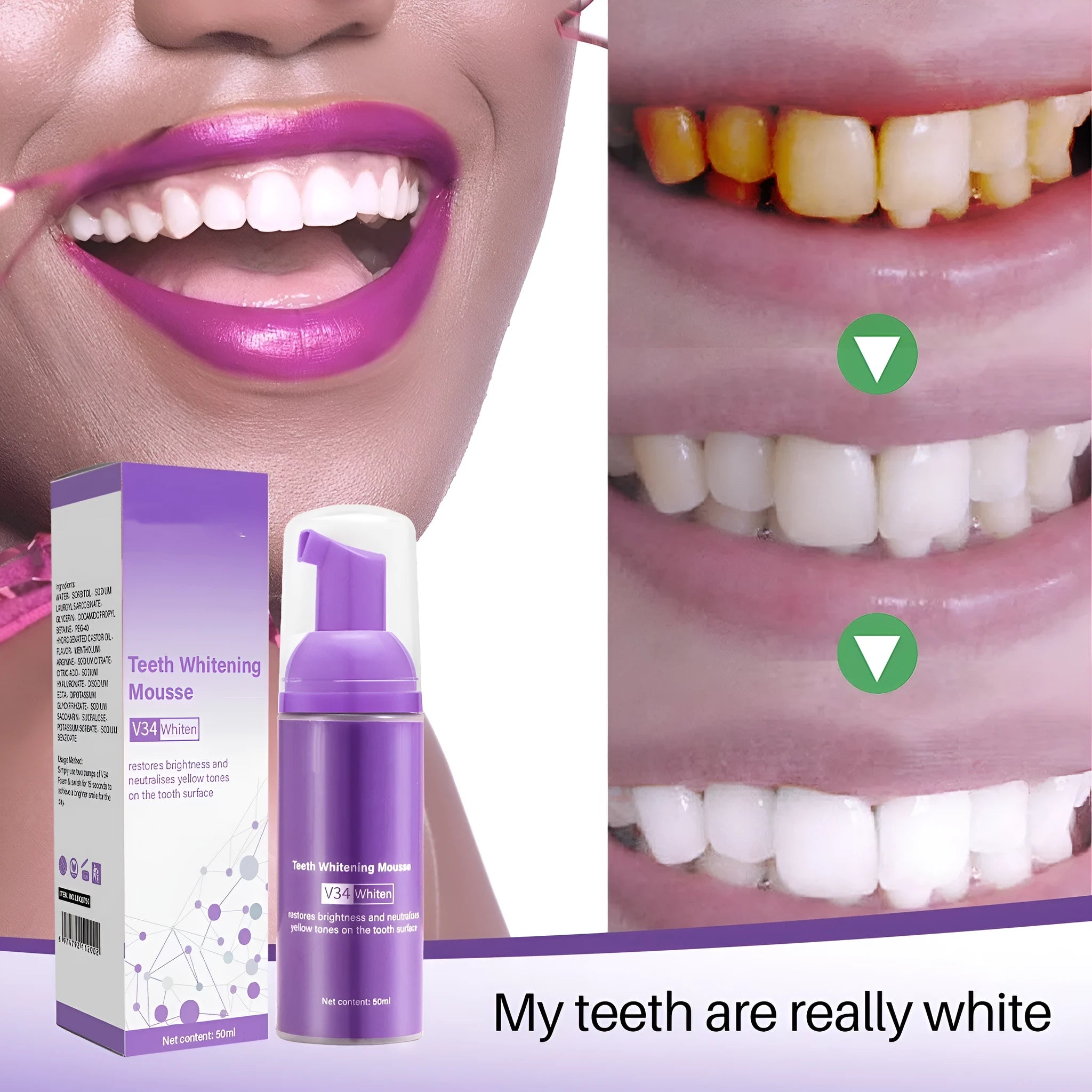 Oral care teeth mousse 50ml tube for removing smoke stains and smoke spots from teeth