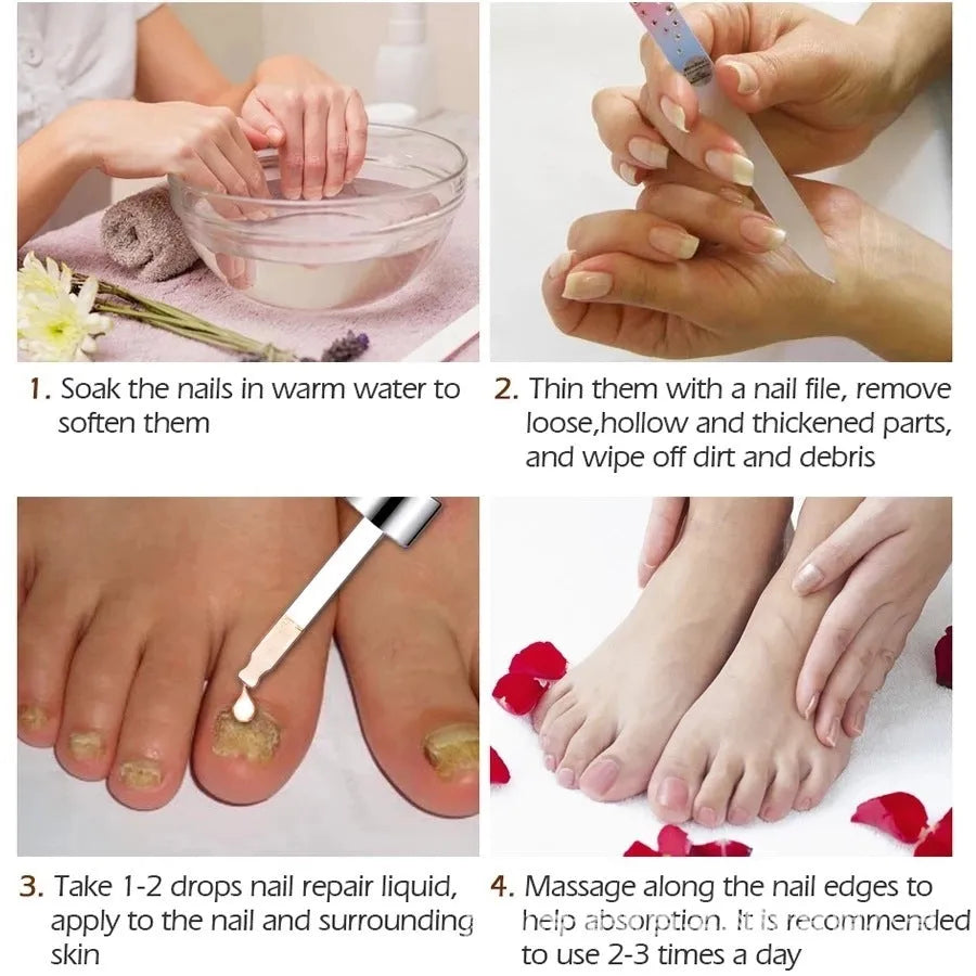 Jiagou repair dust for deck liquid antimicrobial 10ml whitening antibacterial foot treatment