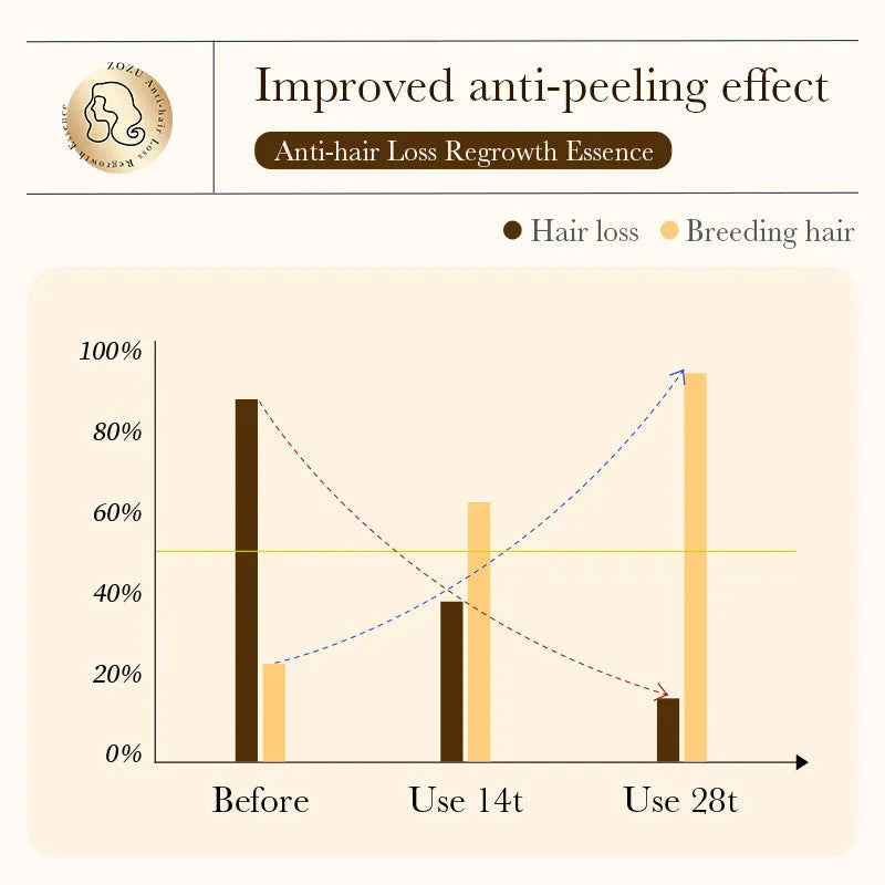 20ml Full English anti-hair loss facial essence in standard specification packaging