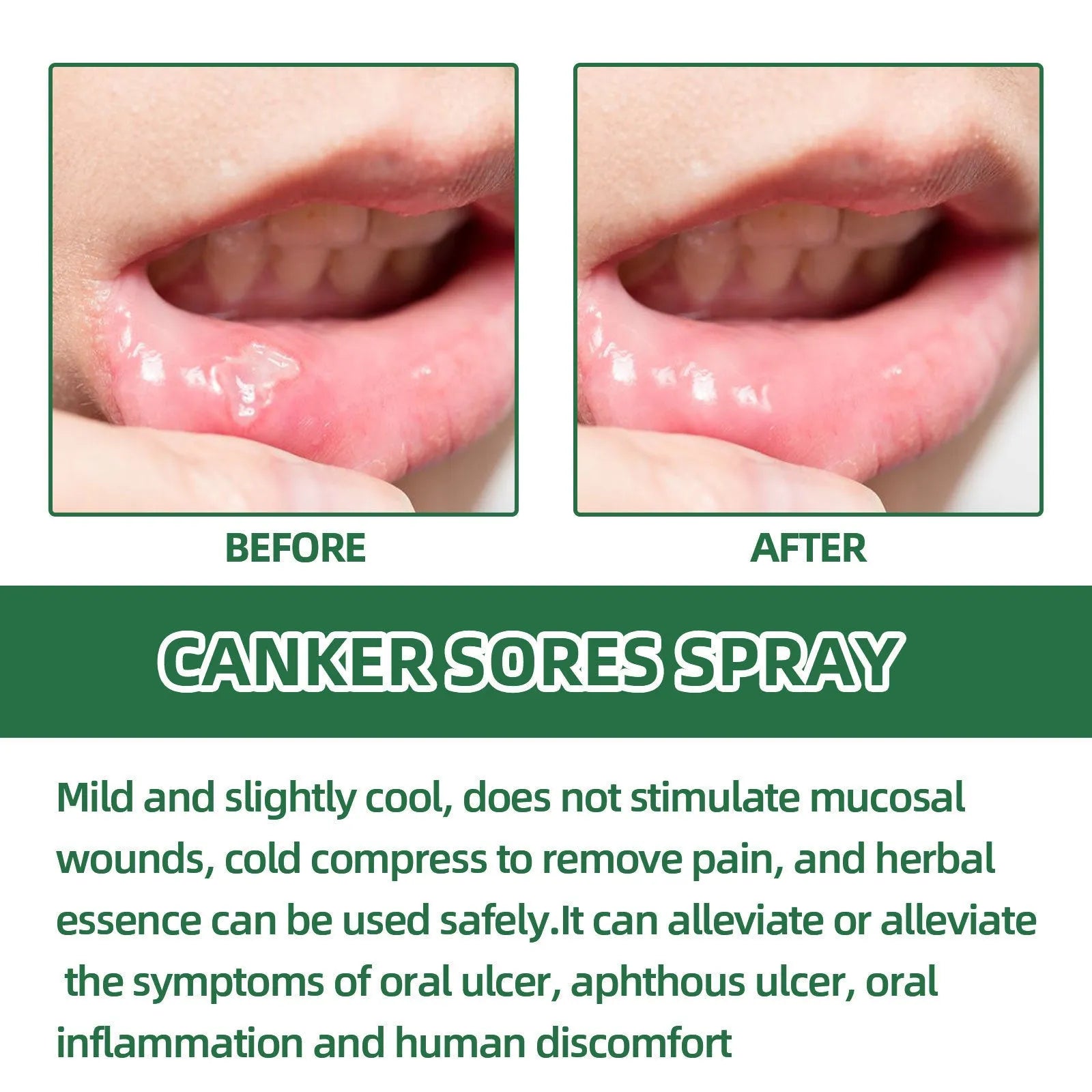 20ml mint breath cleaning spray in boxed packaging for adult oral care