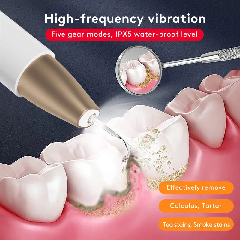 Gold ultrasonic tooth cleaner for tartar removal and stain reduction