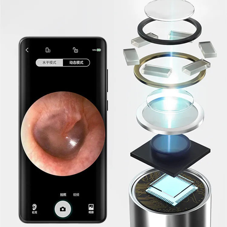 Smart visual ear spoon with 5MP high-definition endoscope lens and LED light for safe ear cleaning