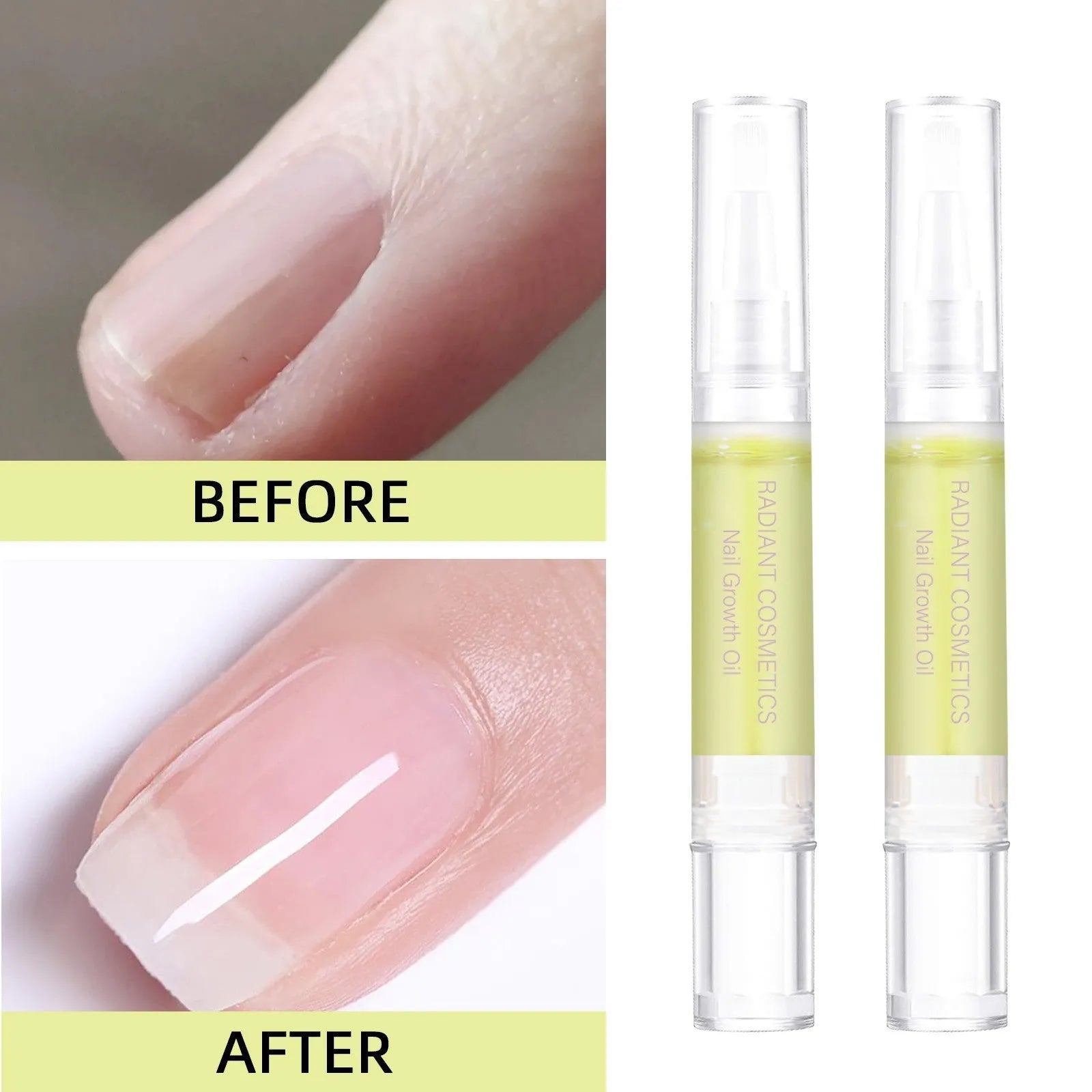 3ml nail growth treatment oil bottle for cuticle moisturising and wash-free application