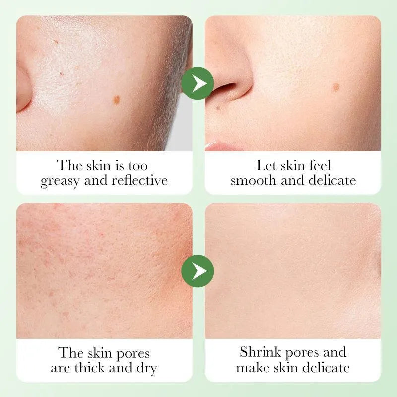 Moisturising Centella asiatica skin care set with six products including cleanser toner lotion eye cream and face cream