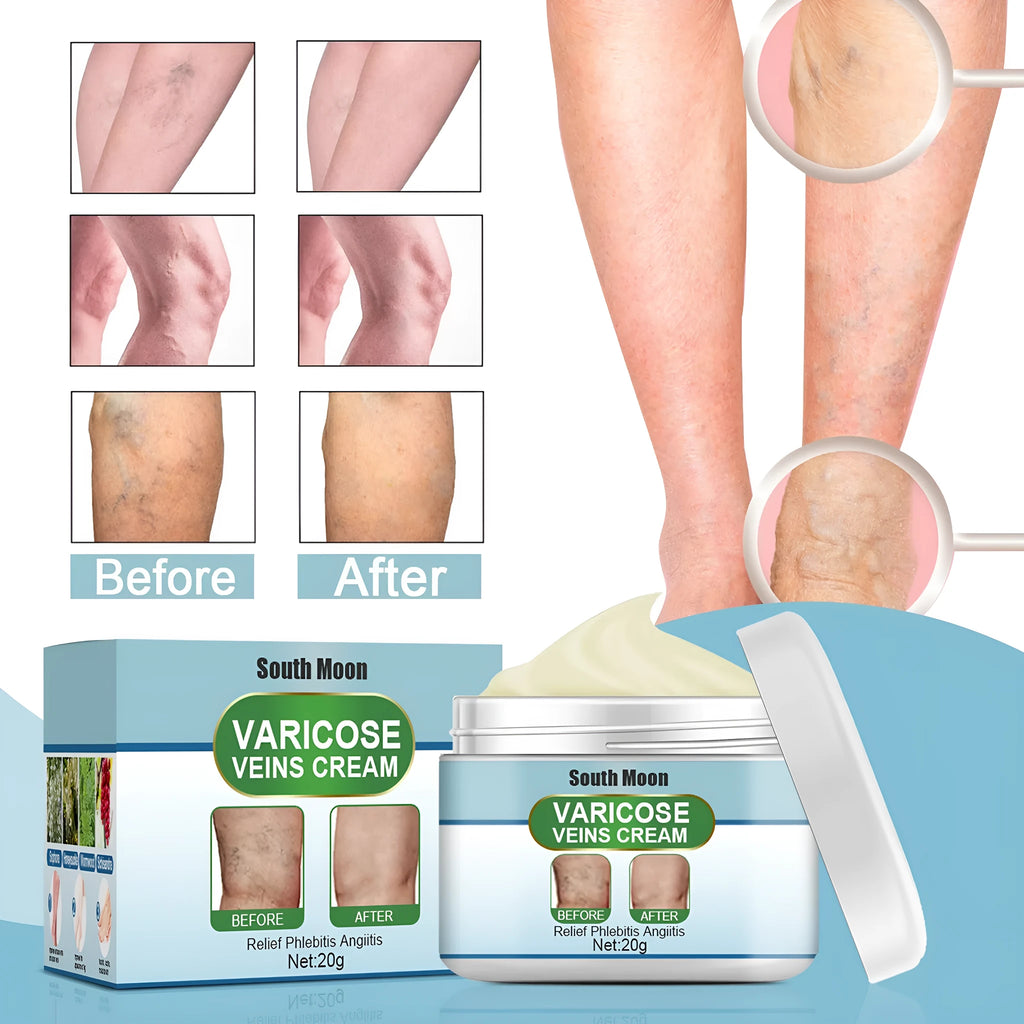 20g tube of vein repair cream for leg vein relief and bulge treatment.
