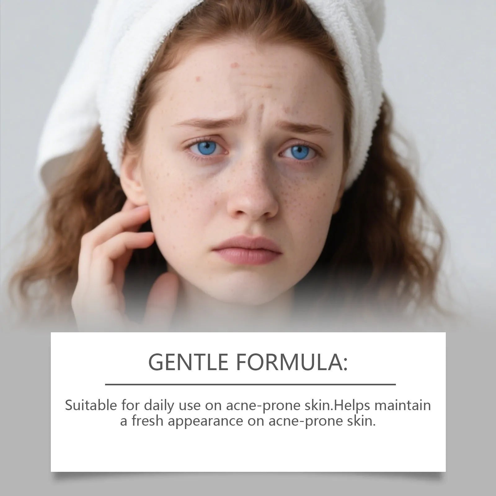 80 hydrocolloid facial acne patches for gentle blemish treatment