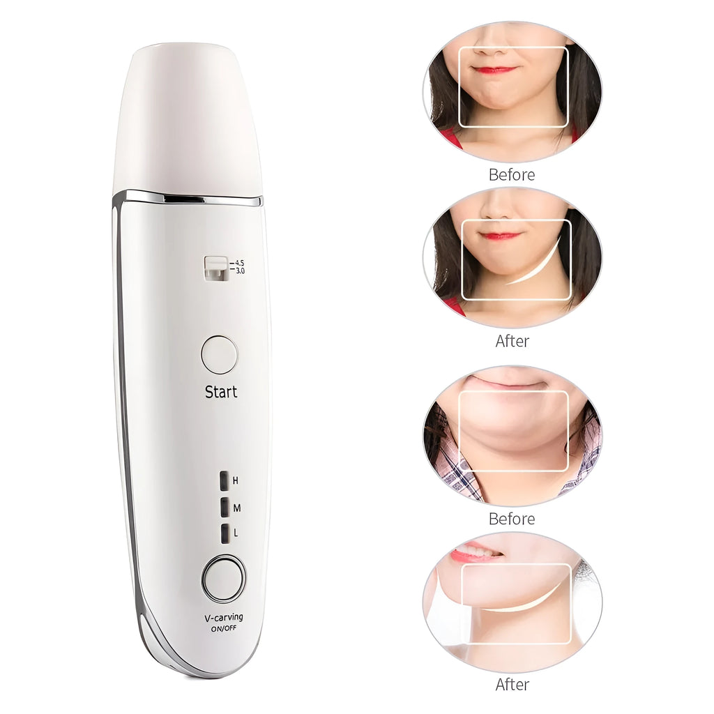 Wrinkle Removal V-Shape Anti-Aging Skin Care Beauty Device in hand for home use