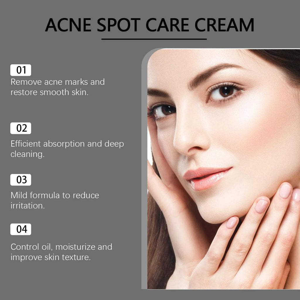 15g container of acne removing face cream with mint leaf, tea tree oil, and aloe ingredients