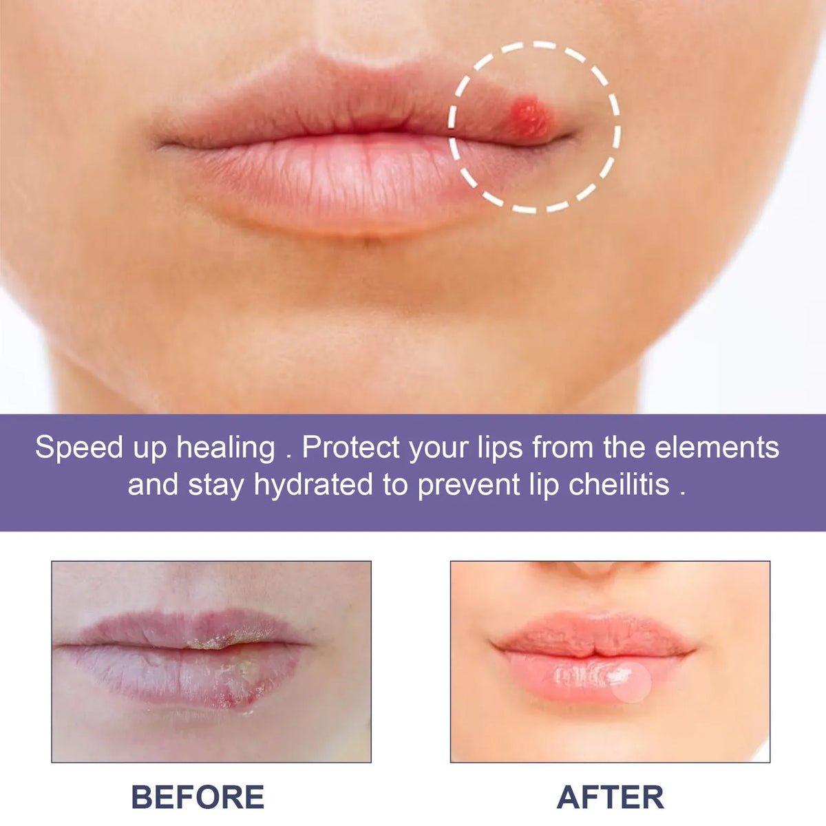 Lip care patch pack of 36 for moisturising dry cracking lips, universal skin type product