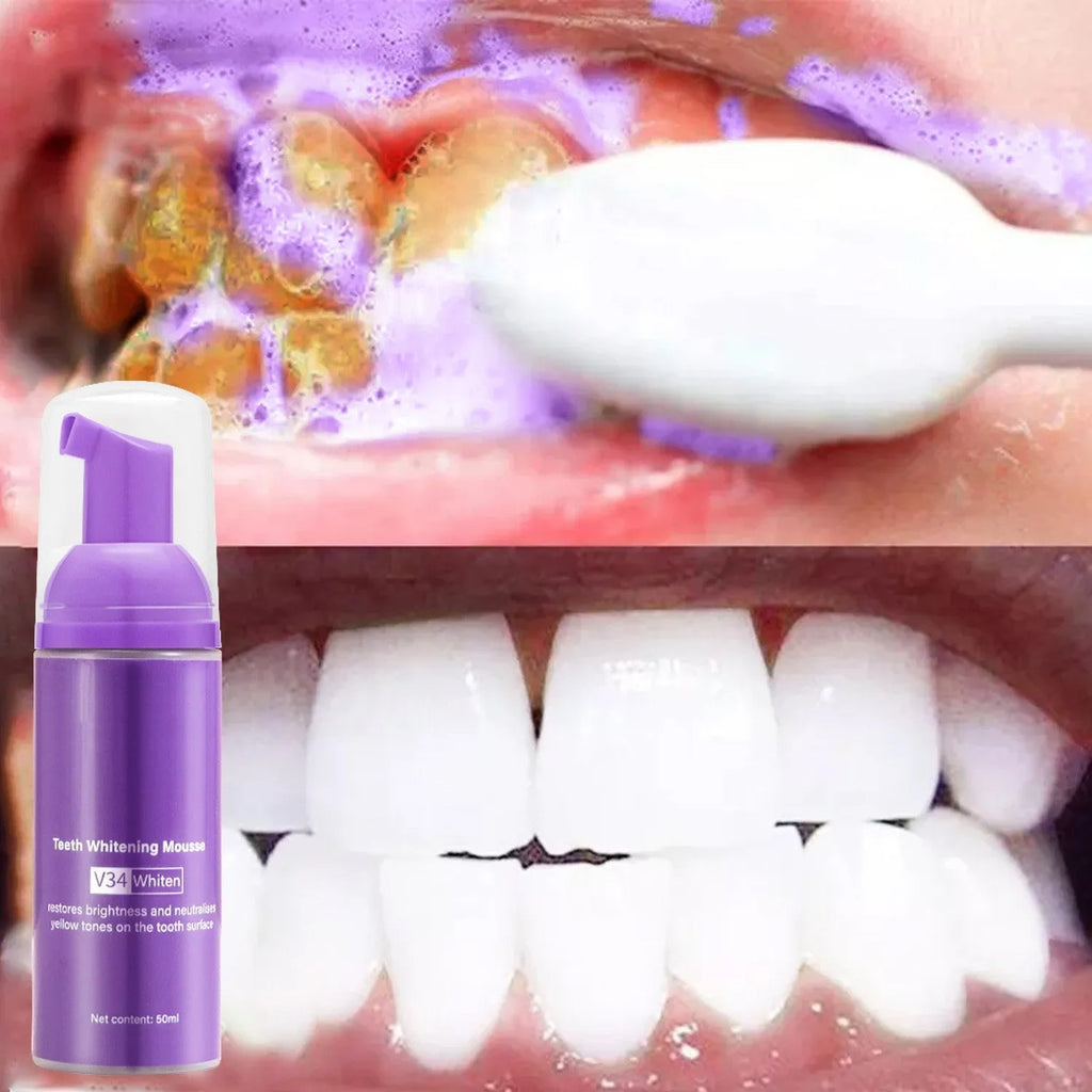 Oral care teeth mousse 50ml tube for removing smoke stains and smoke spots from teeth
