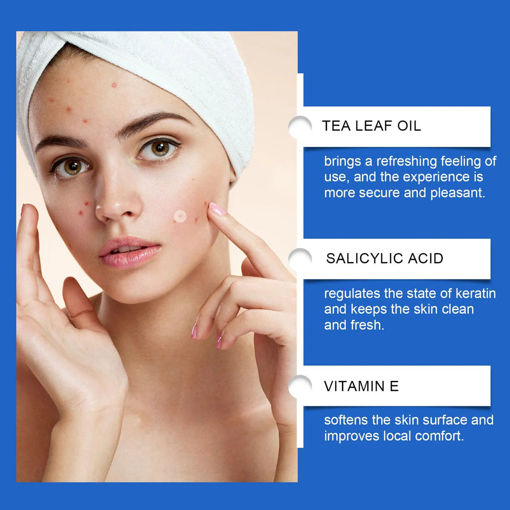 216 tea tree oil and vitamin E hydrocolloid acne patches for facial blemish treatment