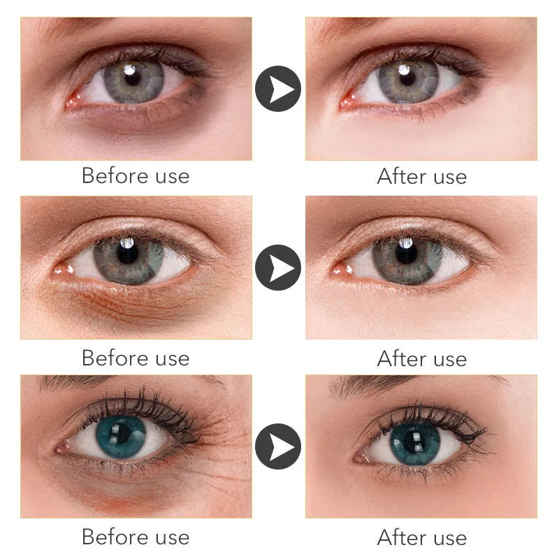 30ml eye cream for women anti-wrinkle dark circle reduction beauty product