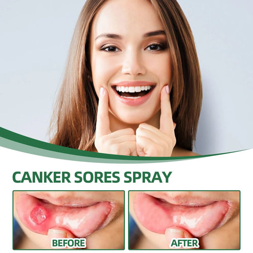 20ml mint breath cleaning spray in boxed packaging for adult oral care