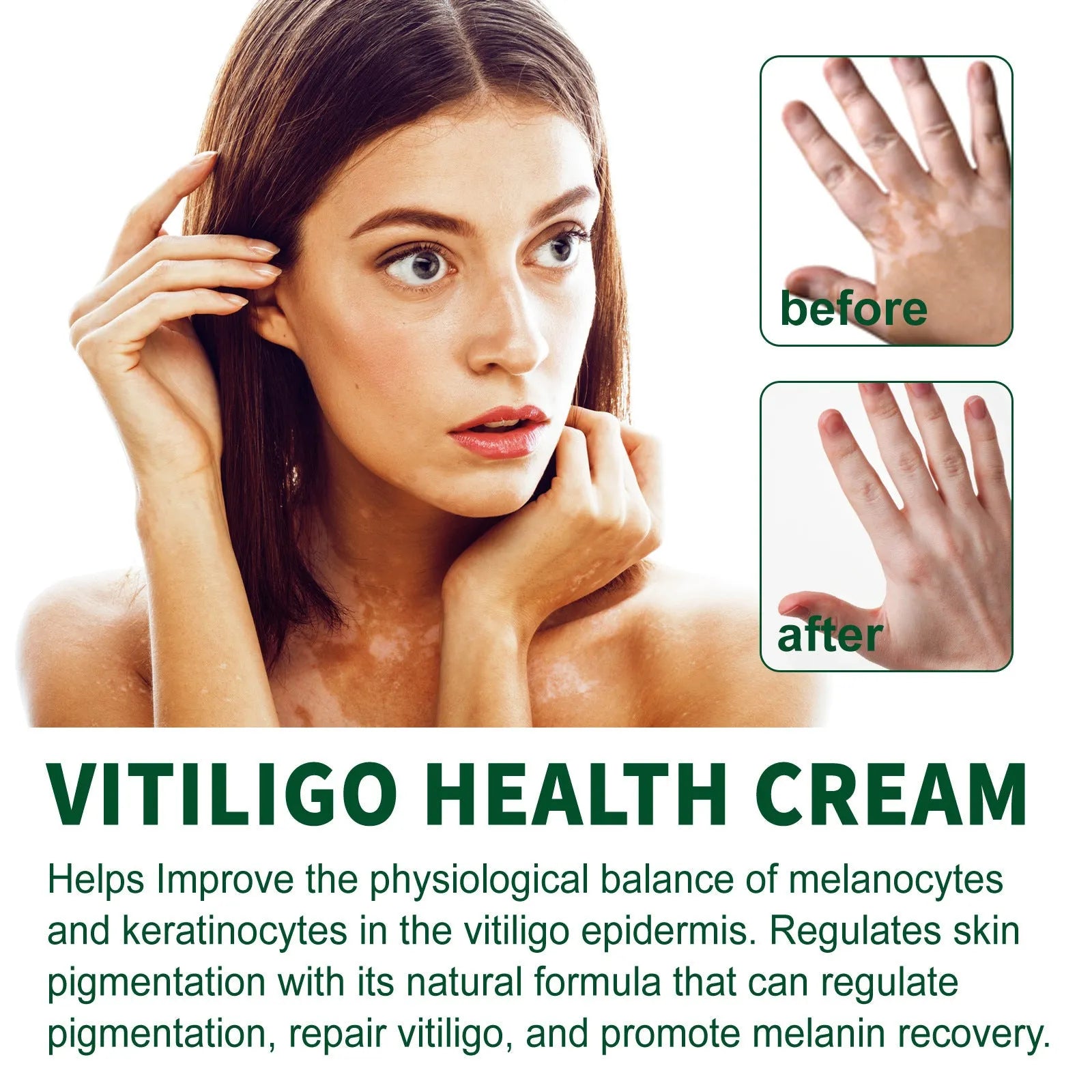 35g tub of universal skin care body cream for cleansing and moisturising.