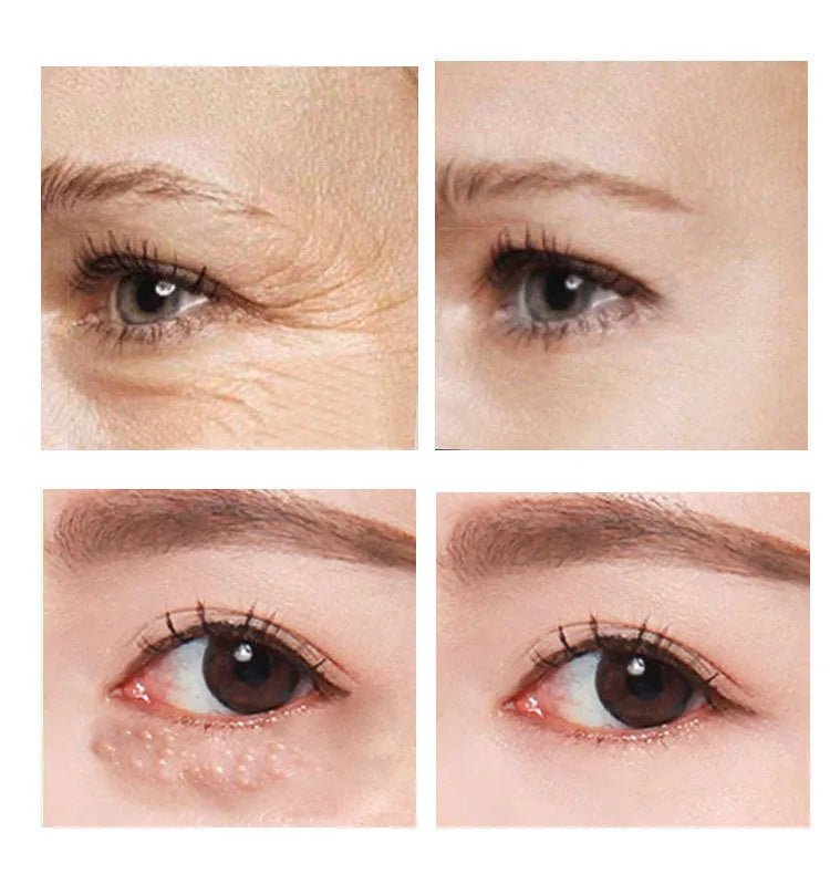 30ml eye cream for women anti-wrinkle dark circle reduction beauty product