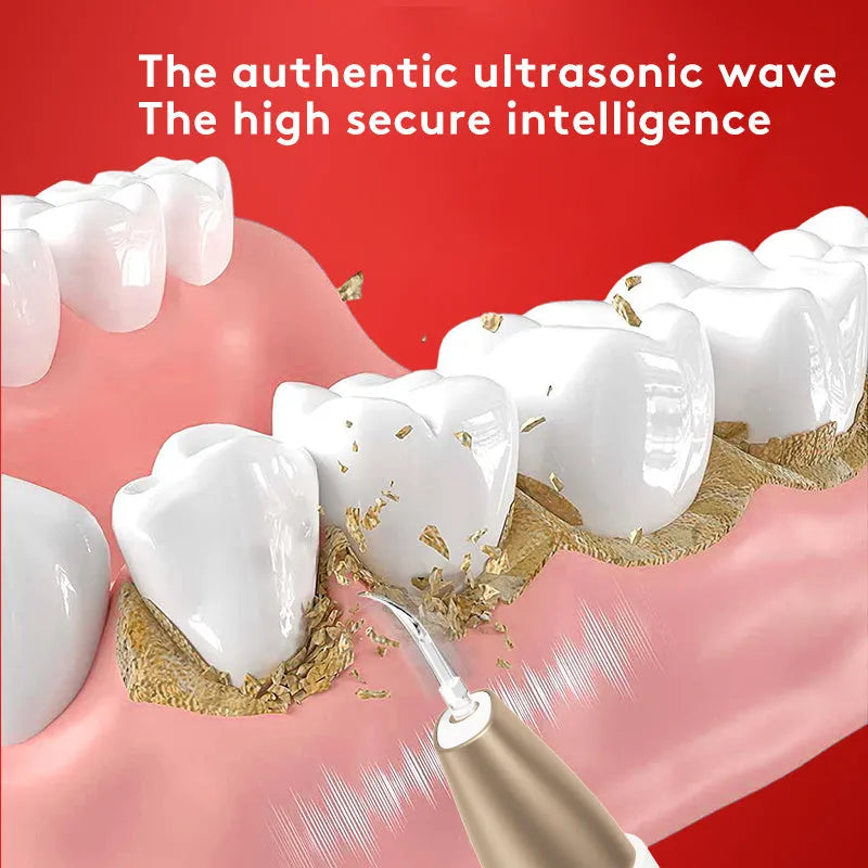 Gold ultrasonic tooth cleaner for tartar removal and stain reduction